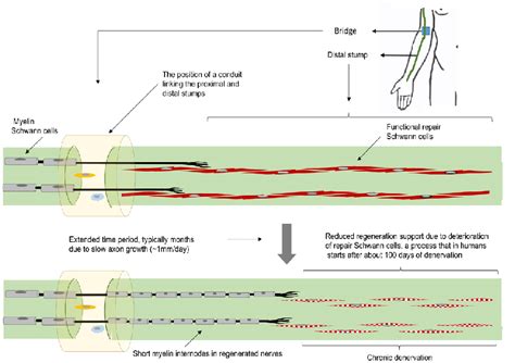 Changes in the Schwann cell population in chronically degenerated... | Download Scientific Diagram