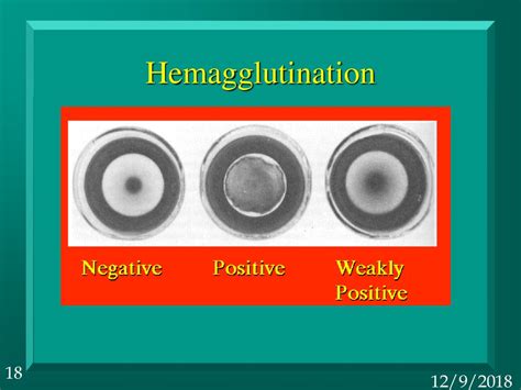 Applications of the Immune Response - ppt download