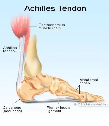 Achilles Tendon Rupture: Treatment, Test, Symptoms & Recovery Times