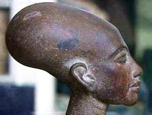 The World-wide Mysterious Phenomena Of Elongated Skulls | Ancient Origins