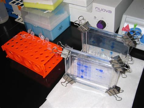 Coomassie Blue staining of two gels. Coomassie blue staining is used to visualize all of the ...