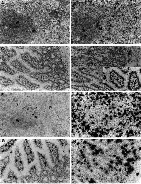 Detection of perforin and granzyme B gene expression in the spleen and... | Download Scientific ...