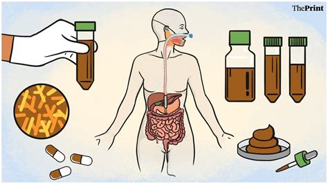 Poop has its uses too. Faecal transplants are the new treatment for cancer, liver disease