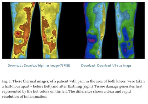 Earthing and Grounding: Science, Benefits, How to - Dr. Robert Kiltz