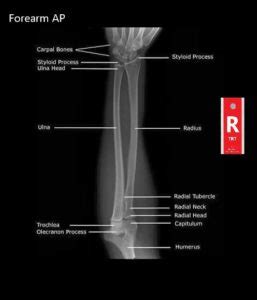 Student Study Guide: Forearm Anatomy