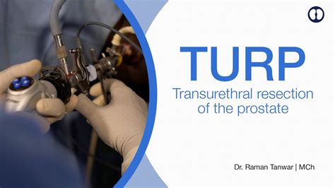 TURP / HoLEP: Prostate Surgery Kya hai aur kab ki jaati hai. Thulium Laser Prostate Surgery ...