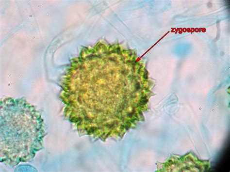 www.scienceexamtopic.com: Information of Mucor