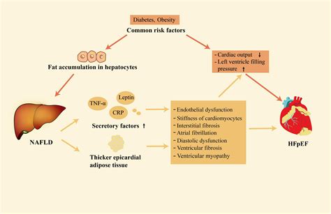 Frontiers | Effects of treatment of non-alcoholic fatty liver disease on heart failure with ...