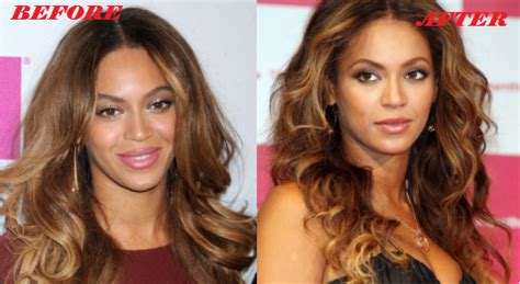 Beyonce Plastic Surgery Before and After Photos - Plastic Surgery Facts