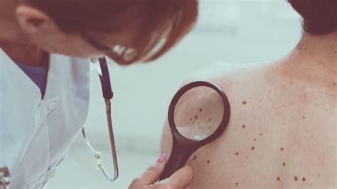 Melanoma Skin Cancer May Be Detected Early With Blood Test, Study Finds | Allure