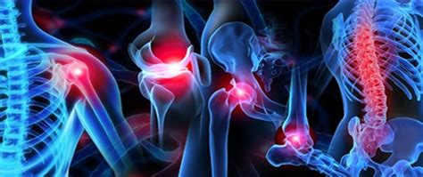 Blog | All You Need to Know About Musculoskeletal Pain