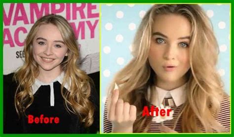 Sabrina Carpenter: Before and After Looks, Current Weight, Surgery, Diet Plan ...