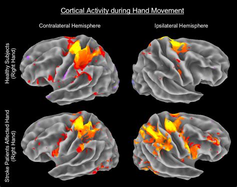 Fmri Brain