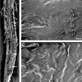 Visualization of Cellulose Microfibrils in the Innermost Layer of... | Download Scientific Diagram