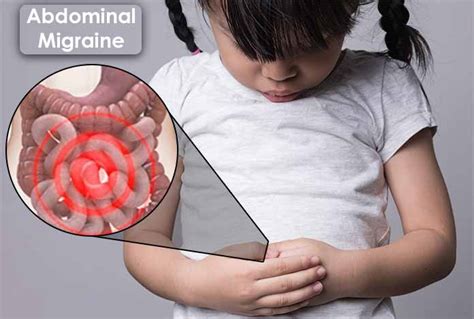 Understanding Abdominal Migraine: Causes, Symptoms, and Treatment - Phonemantra