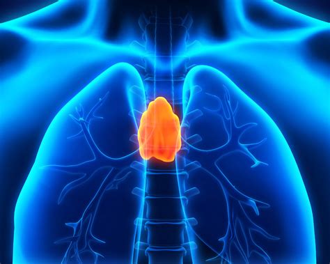 Thymus Cancer | Thymoma | MedlinePlus