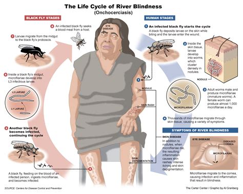 Multimedia Resources River Blindness