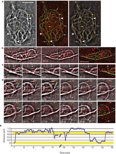 Retrospective staining of APC after imaging microtubule dynamics.(a)... | Download Scientific ...