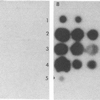 Dot blot hybridization of nucleic acid extracts with HAV ssRNA probes ...