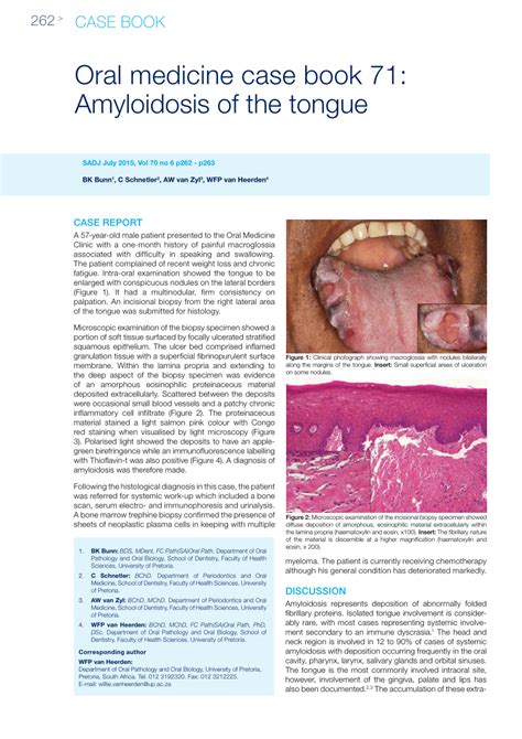 (PDF) Oral medicine case book 71: Amyloidosis of the tongue