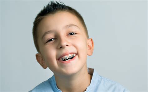 When Should Kids Get Braces? How to Tell When It's Time for Braces