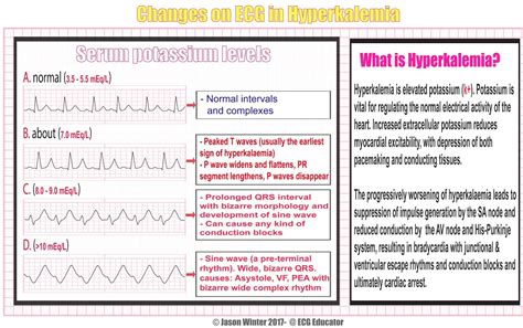 Pin on Nursing tips