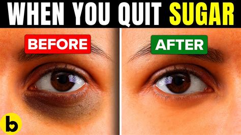 This Is What Happens To Your Body When You Quit Sugar - YouTube