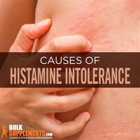 Histamine Intolerance: Signs, Causes & Treatment