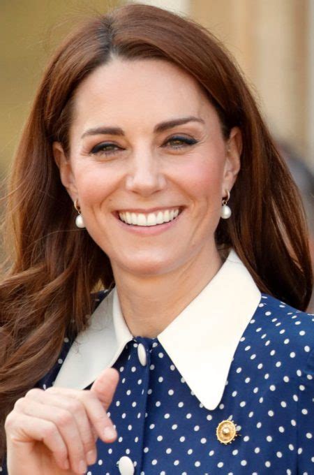 Kate Middleton's teeth Before and After [PHOTOS]