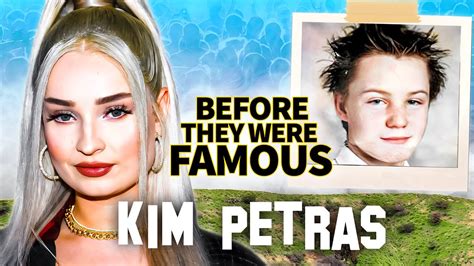 How Did Kim Petras Look Before Surgery? Grammy Winner Surgery And ...