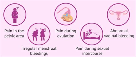 Symptoms of salpingitis