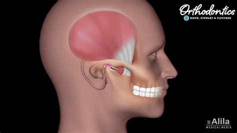 Myofascial Pain Syndrome Face