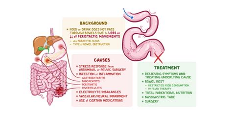 Adynamic Ileus Causes & Treatments, Know It All Here! - Medical Treatment