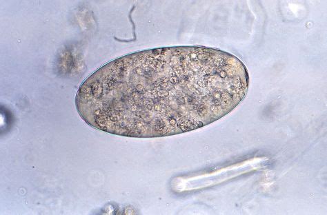 9 Best Fasciolopsis buski images | Microbiology, Flatworm, Liver fluke