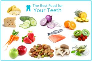 Diet and Oral Health - Dr. Amini