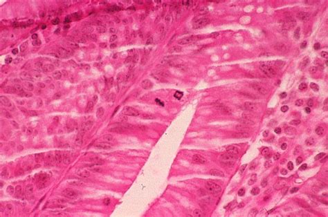 Basic Histology -- Mitotic Figures (dark staining near top, central venetian blind artifact ...