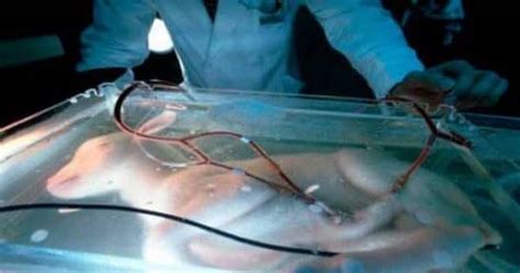 Scientists Create An Artificial Womb To Help Premature Babie