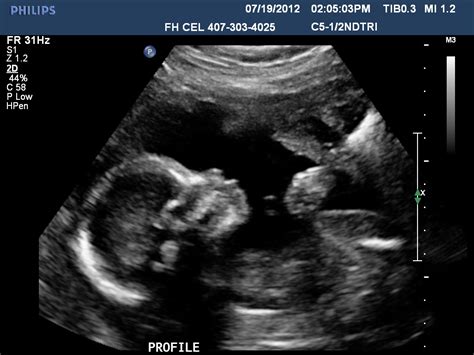 Our "1st" Baby - The McCormicks: 2nd Trimester Ultrasound - Photos