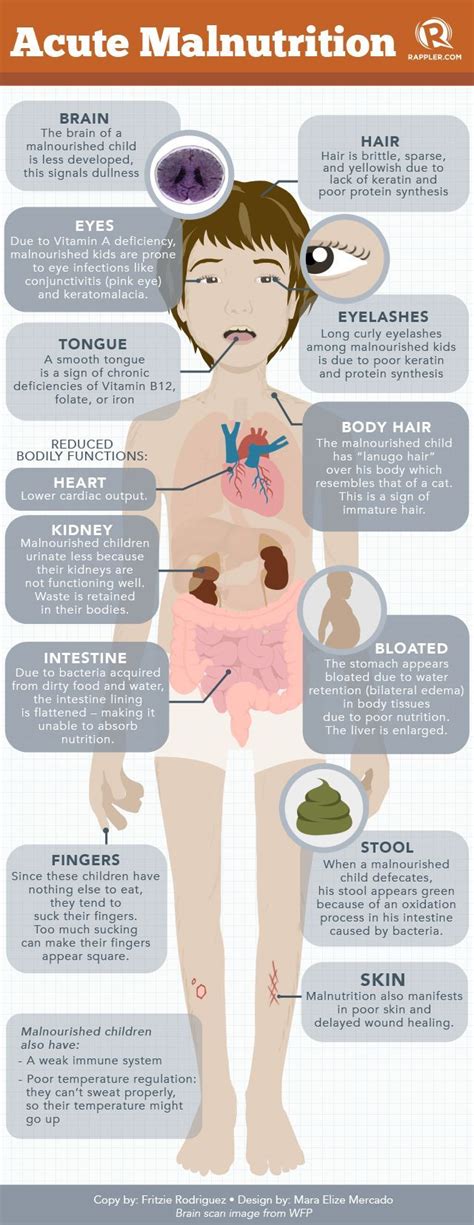 Pin on Nutrition