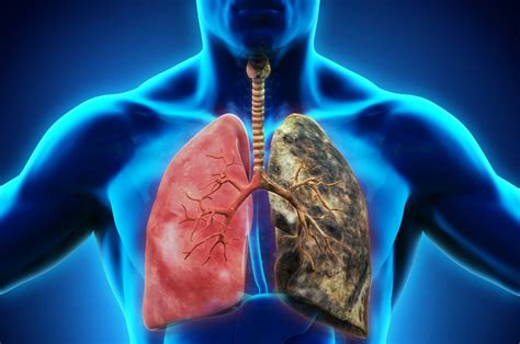 Overview On Lungs Disease