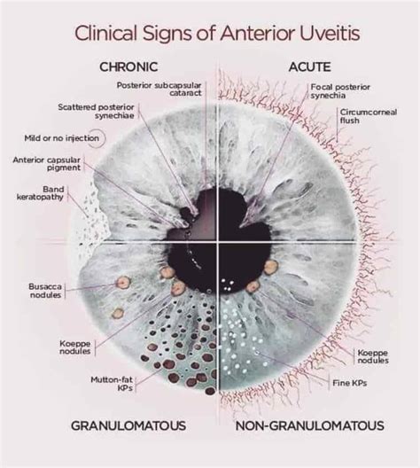 Clinical Signs of... - Ophthalmology-Notes And Synopses