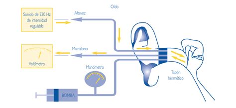 Tympanometry: what it is and what it is used for - Blog of Kiversal