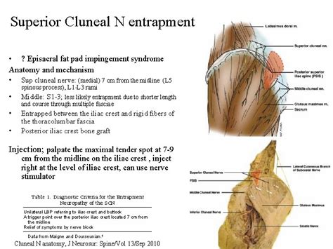 Common Injection Techniques In PMR Part II Buttock