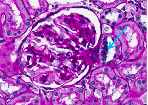 Macula Densa Histology