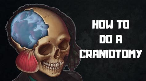 How to do a craniotomy - YouTube