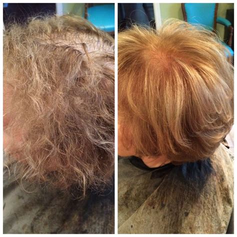 Perm damaged hair repaired with Olaplex