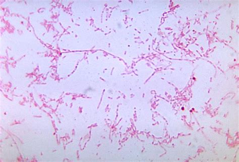 Fusobacterium necrophorum; Sphaerophorus necrophorus