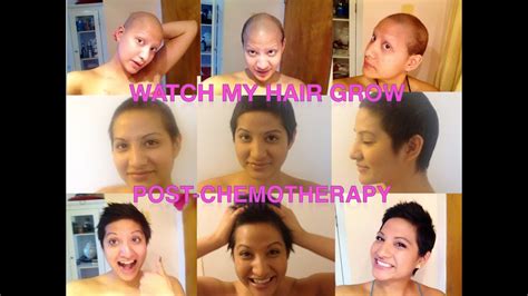 Hairgrowth Post-Chemotherapy | Young women with Breast Cancer - YouTube