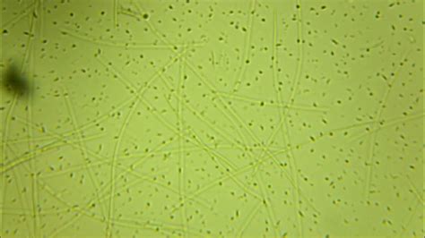Phytoplankton under microscope - batch 1 - YouTube