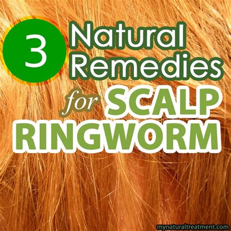 Here you have the most amazing natural remedies for scalp ringworm, also known in medical terms ...